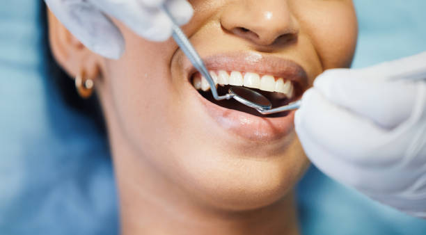 Best Weekend Emergency Dental Services in Broadview, IL