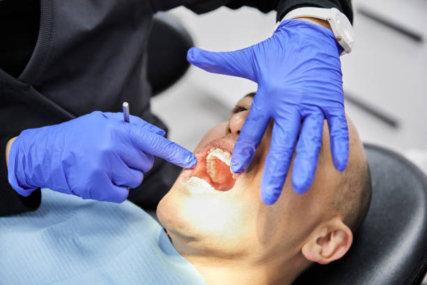 Best Emergency Root Canal Therapy in Broadview, IL